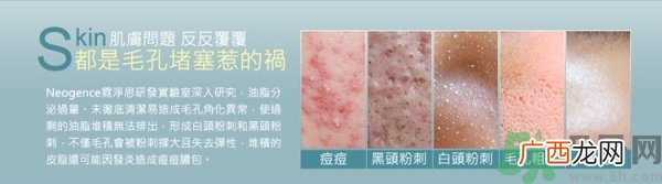 霓净思Neogence粉刺溶解精华液真假辨别图