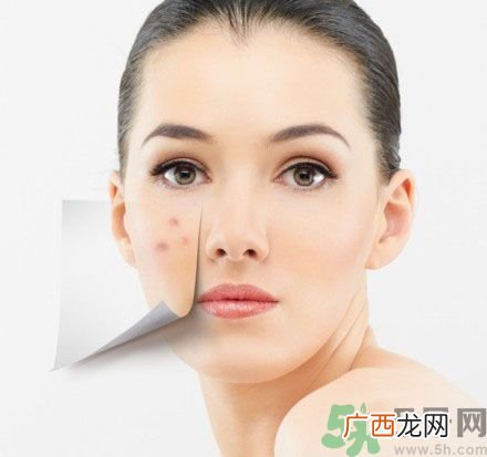 脸上有斑怎么去除?祛斑的小偏方有哪些?