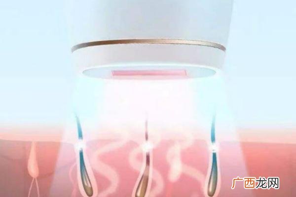 激光脱毛的注意事项激光脱毛的副作用有哪些