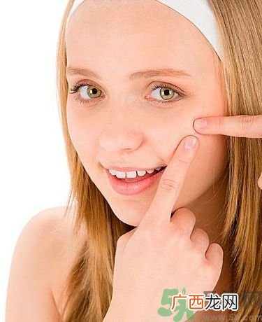脸上有痘印怎么去除？去除痘印的小妙方？