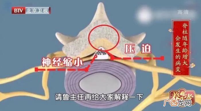 练后背肌肉,人老先老背一定不能忽视锻炼后背的肌肉
