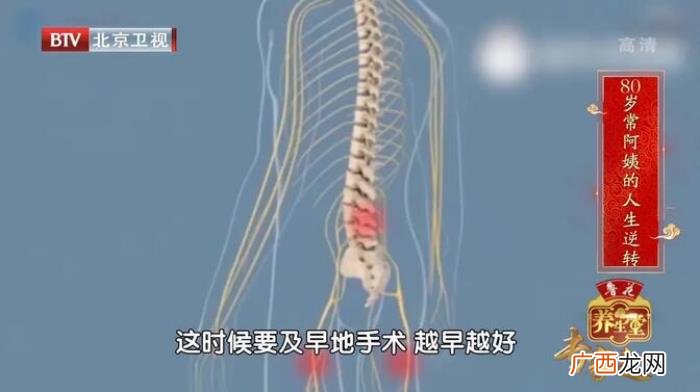 练后背肌肉,人老先老背一定不能忽视锻炼后背的肌肉