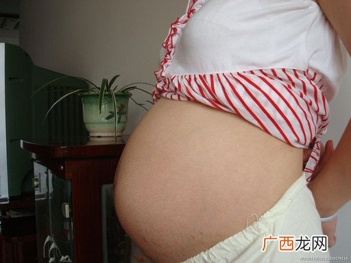 妊娠纹怎样能消除