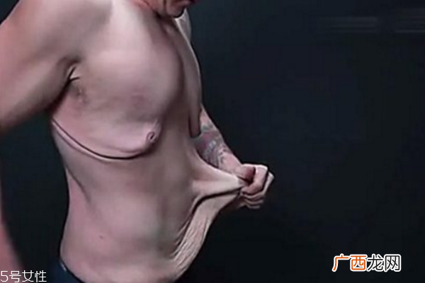 皮肤松弛，你应该为肌肤补充营养