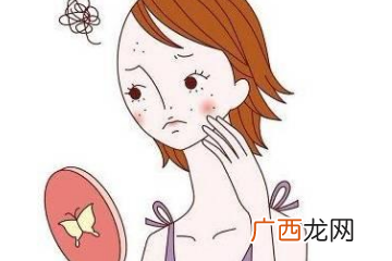 青春痘的治疗方法
