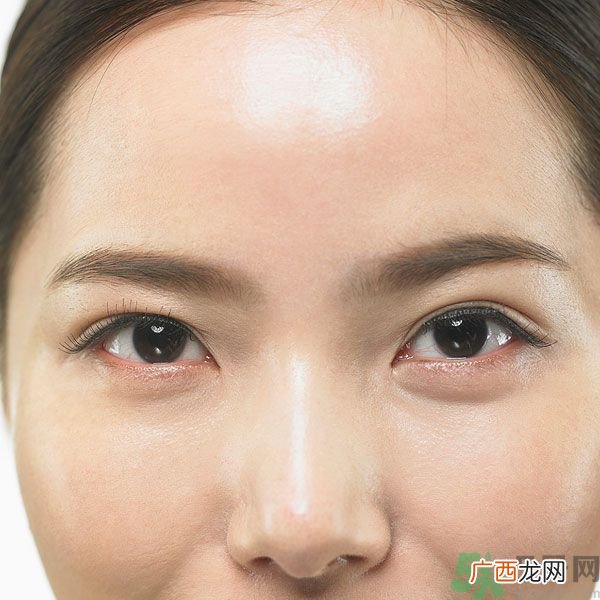 眉周纹是怎么形成的？眉周纹怎么去除？