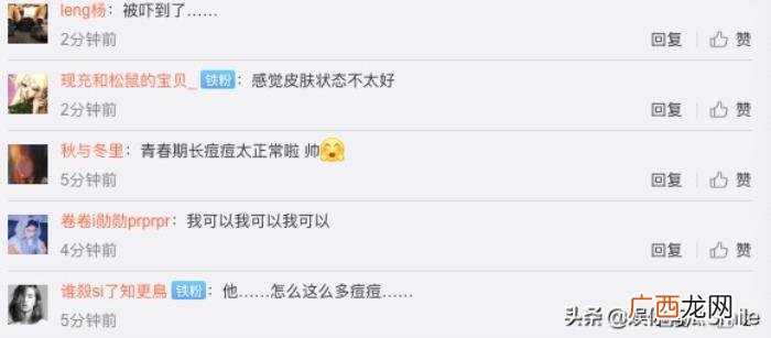 王源无滤镜，王源外媒镜头下无美颜无滤镜照片曝光