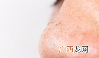 荷荷巴油怎么去黑头 荷荷巴油如何去黑头