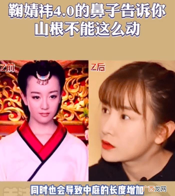 鞠婧祎鼻子，看脸博主直言鞠婧祎的鼻子又整了但很失败