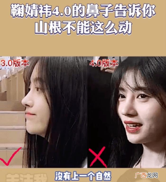 鞠婧祎鼻子，看脸博主直言鞠婧祎的鼻子又整了但很失败