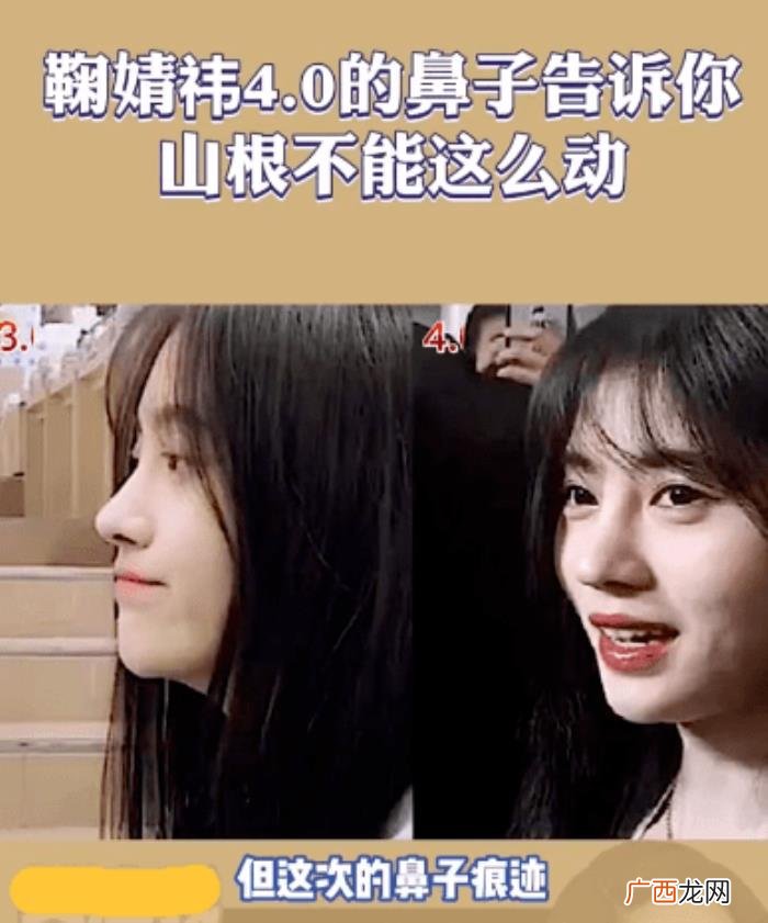 鞠婧祎鼻子，看脸博主直言鞠婧祎的鼻子又整了但很失败