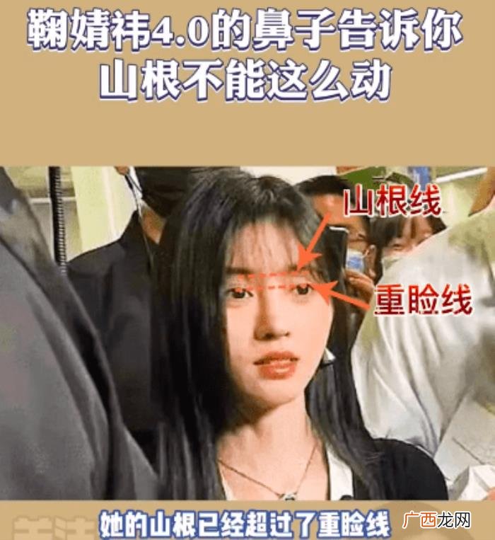 鞠婧祎鼻子，看脸博主直言鞠婧祎的鼻子又整了但很失败
