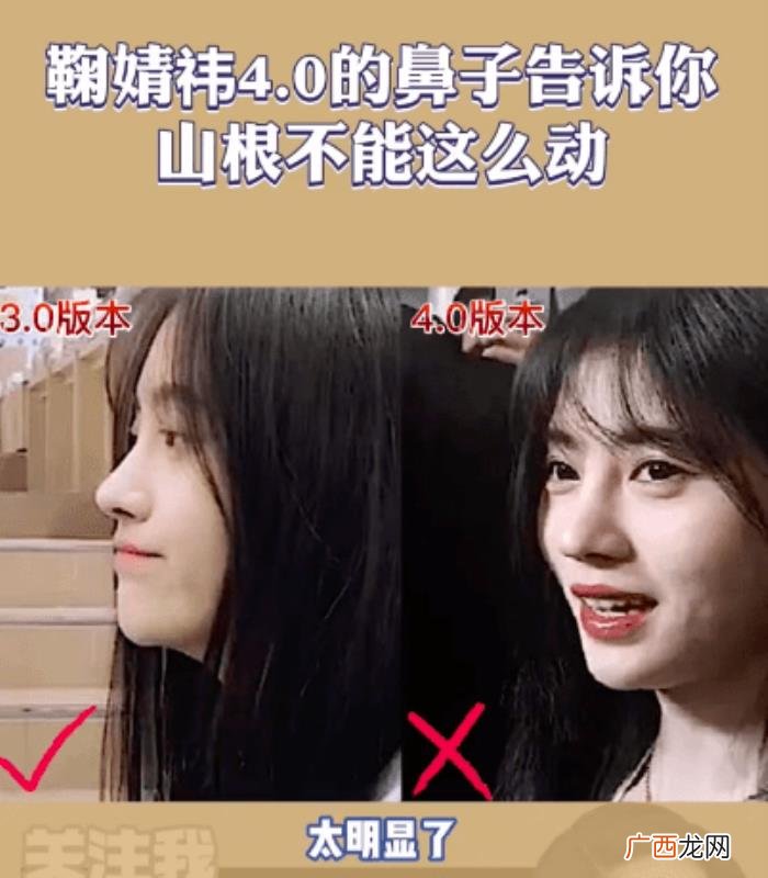 鞠婧祎鼻子，看脸博主直言鞠婧祎的鼻子又整了但很失败