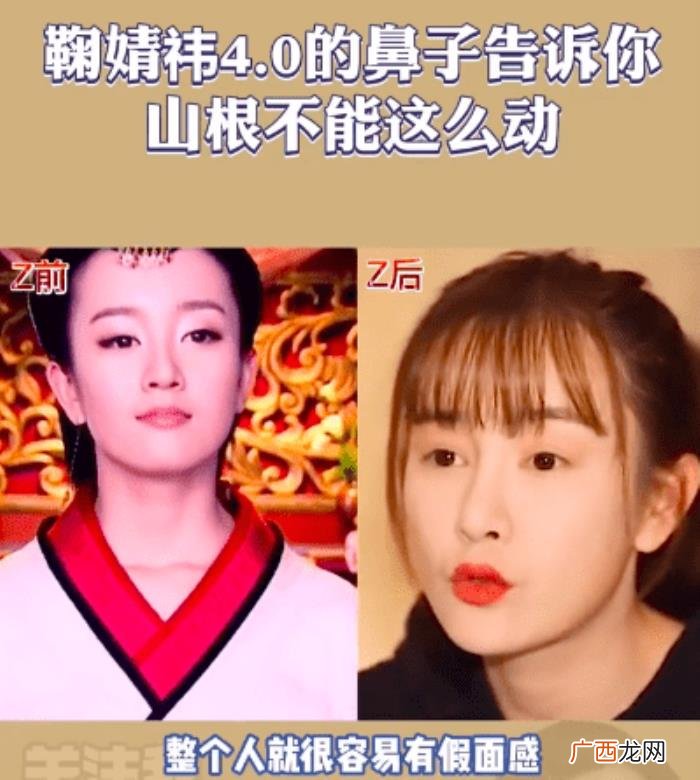 鞠婧祎鼻子，看脸博主直言鞠婧祎的鼻子又整了但很失败
