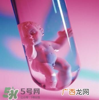 试管婴儿性别能确定吗 试管婴儿可以选择性别吗