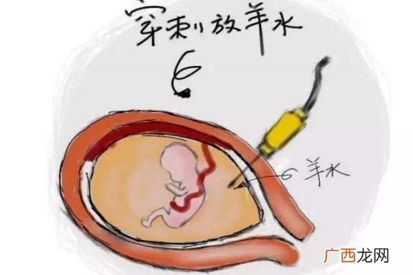 孕妇羊水过多对胎儿有害吗 会危及胎儿性命