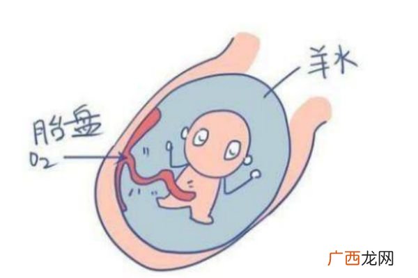 孕妇羊水过多什么症状 妈妈们要注意