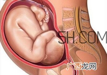 什么情况下需要剖腹产 剖腹产最全科普