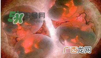 多胞胎是怎么生产的？多胞胎应选择什么分娩方式