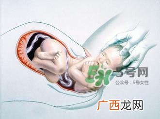 顺产和剖腹产哪个好？顺产和剖腹产哪个痛？