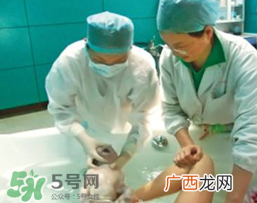 无痛分娩在中国普及难的原因 无痛分娩为什么不普及？