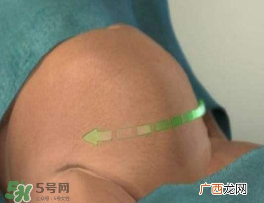 剖腹产的过程 剖腹产的步骤及时间