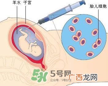 羊水栓塞是怎么回事？羊水栓塞怎么预防？