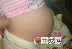 怎样区分真假阵痛,有什么办法可以缓解