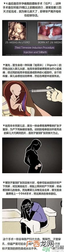 堕胎手术的可怕细节 姑娘们你还堕胎吗?多图