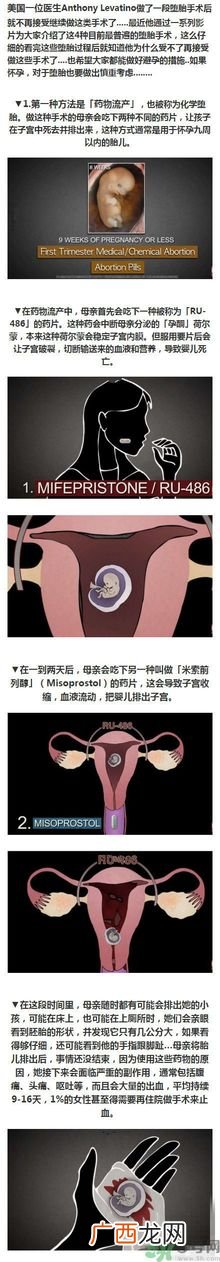 堕胎手术的可怕细节 姑娘们你还堕胎吗?多图