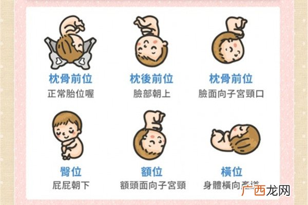 什么是胎位不正图片 胎位不正教你矫正