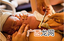 胎儿脐带绕颈一周怎么办还能顺产吗