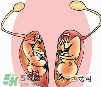 双子宫对怀孕有影响吗?双子宫怀孕要注意什么?