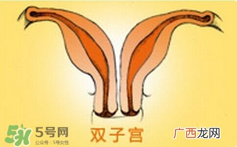 双子宫是什么意思？双子宫可以顺产吗？