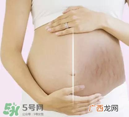长妊娠纹的前兆 长妊娠纹很痒怎么办？