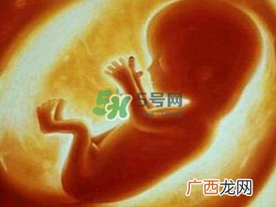 脐带绕颈是什么原因造成的？脐带绕颈是多休息还是多运动？
