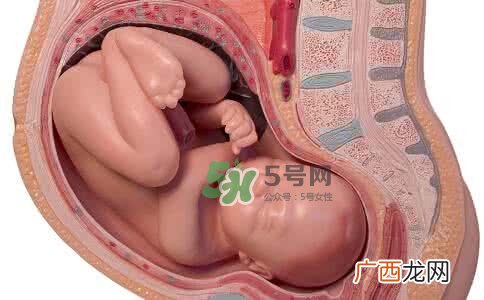 宝宝脐带绕颈只能剖腹产吗？胎儿脐带绕颈孕妇有什么感觉