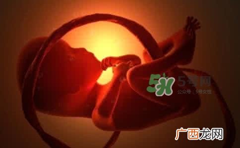 宝宝脐带绕颈只能剖腹产吗？胎儿脐带绕颈孕妇有什么感觉