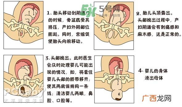 生孩子的过程是怎样的？生孩子的真实过程