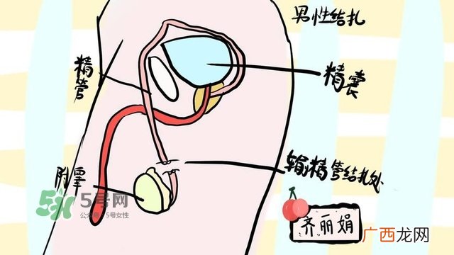 生完二胎一定要结扎吗?生完二胎结扎好不好?