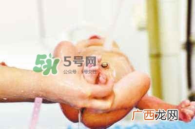 羊水栓塞是医疗事故吗？羊水栓塞多发生于顺产还是剖腹产？