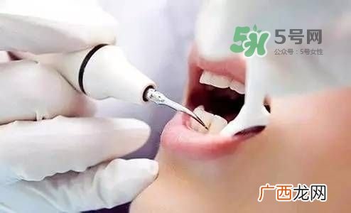 孕妇能矫正牙齿吗？怀孕期间可以矫正牙齿吗？