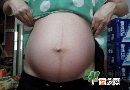 怀女孩肚子上会长毛吗?怀女孩肚子特征图片