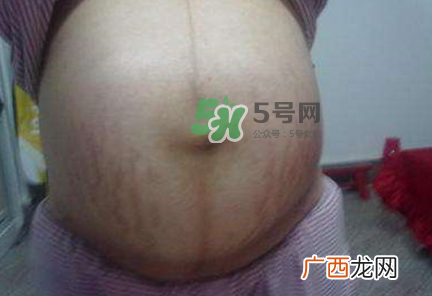 怀女孩肚子上会长毛吗?怀女孩肚子特征图片