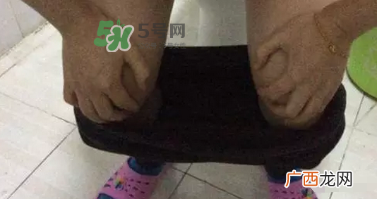 孕期可以蹲着上厕所吗？孕期上厕所会压到宝宝吗？