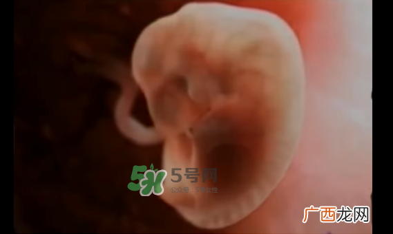 怀孕初期怎么保胎？阴道出血是流产征兆吗？