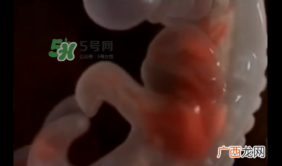 怀孕初期怎么保胎？阴道出血是流产征兆吗？