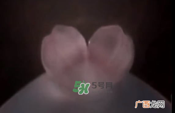 怀孕初期怎么保胎？阴道出血是流产征兆吗？