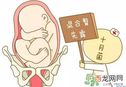 胎位不正能顺产吗？胎位不正怎么办？
