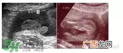 B超单数据怎么看男女？B超单看男女准吗？
